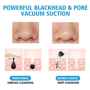 BLACKHEAD SUCKER